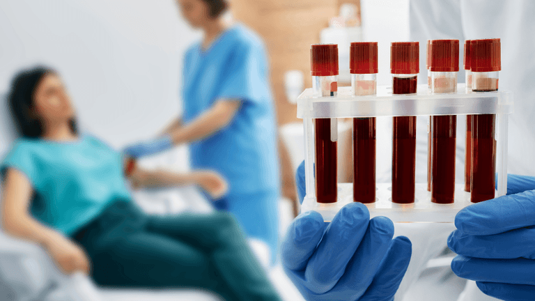 Blood Test for Alzheimer's Disease